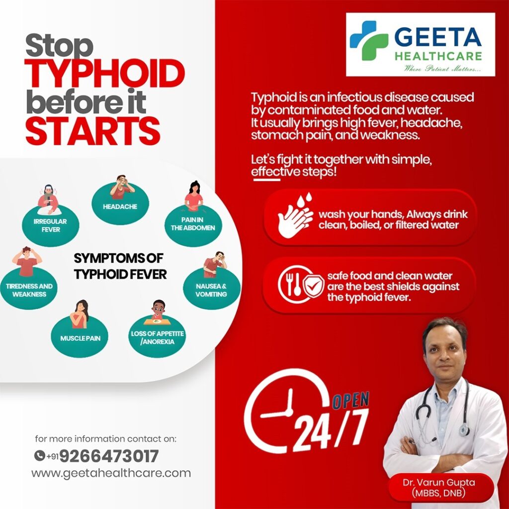 Stop typhoid before It starts